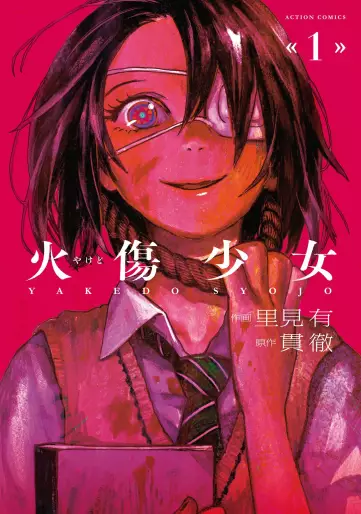 Manga - Yakedo Shoujo vo